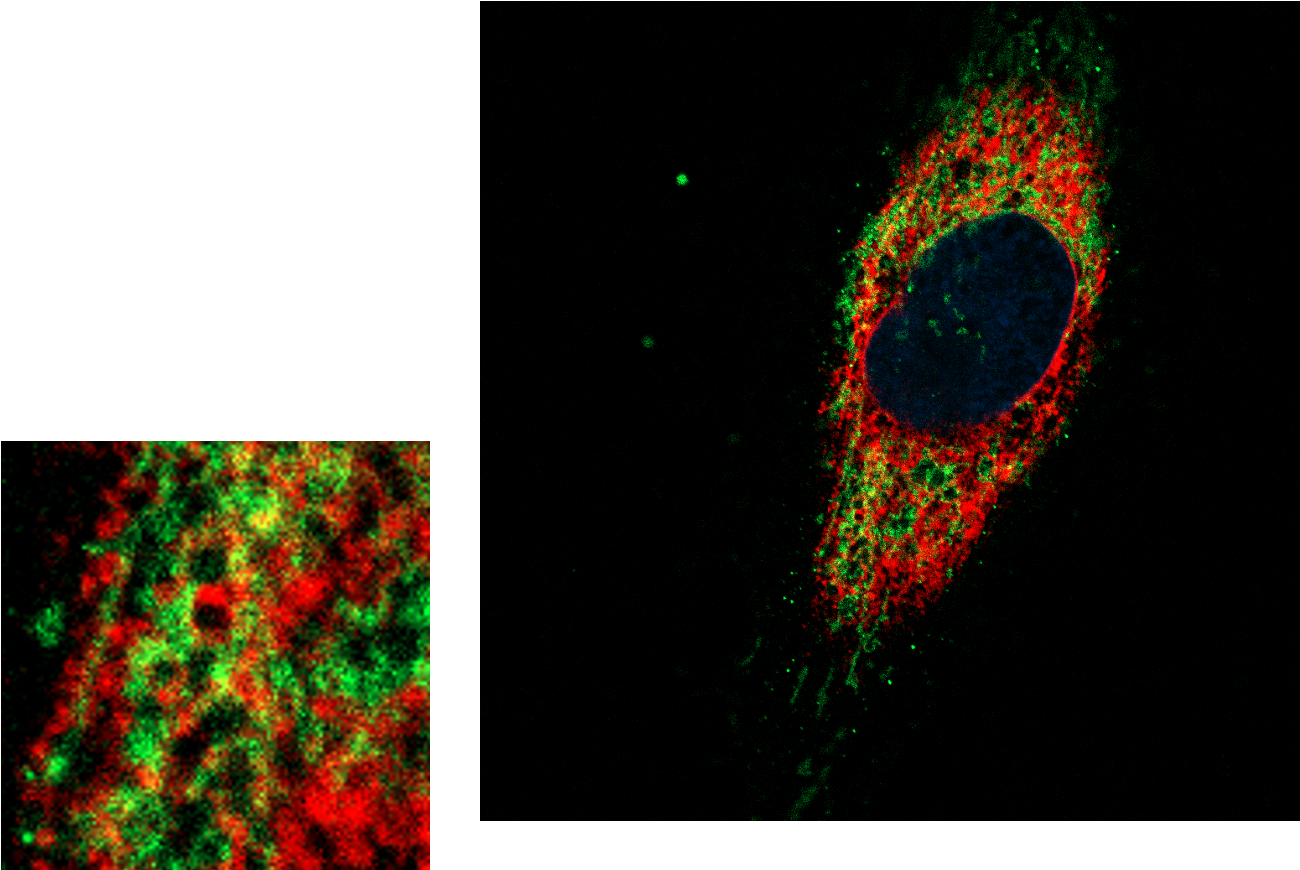 Merged fluorescence image of an astrocyte, with red and green cellular signals surrounding a blue-stained nucleus.