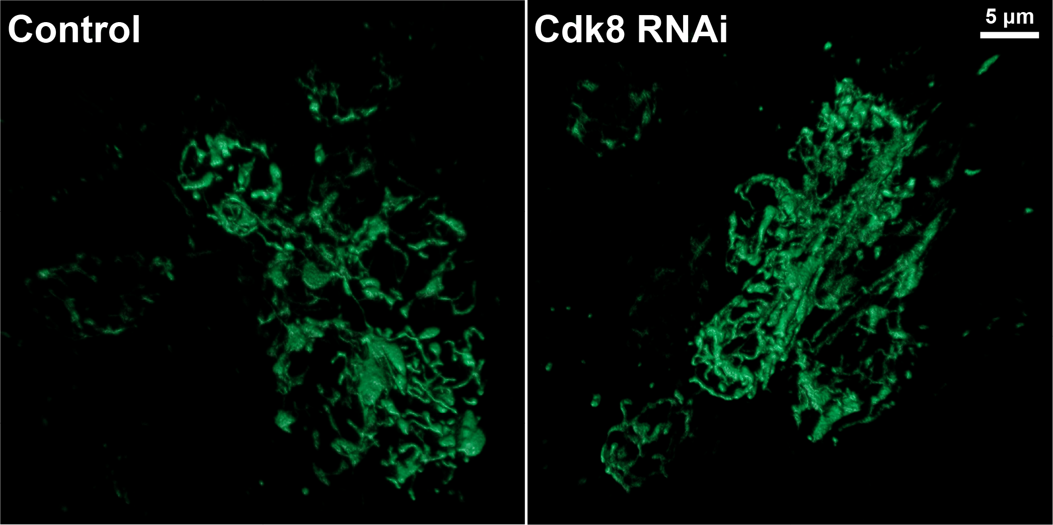 Detail of mito-GFP-labeled mitochondria from the Cdk8 RNAi panel.