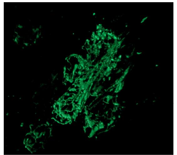 Green fluorescent mitochondrial structures against a dark background.