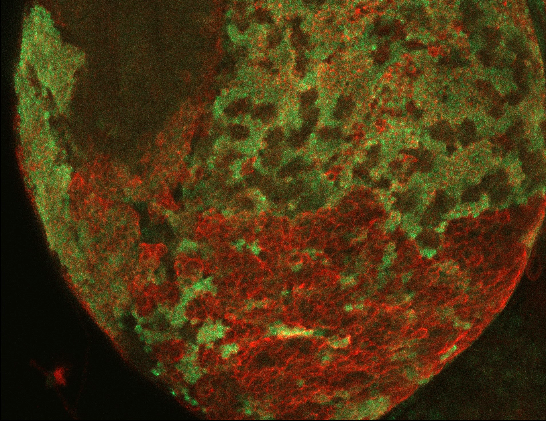 Drosophila brain fluorescence imaging from the PRKCE project, with red and green labeling.